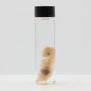 Wet Preservation